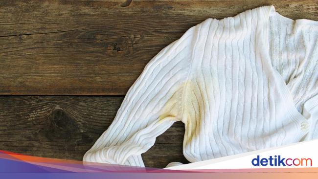 7 Trik Jitu Menghilangkan Kuning pada Pakaian Tanpa Pemutih